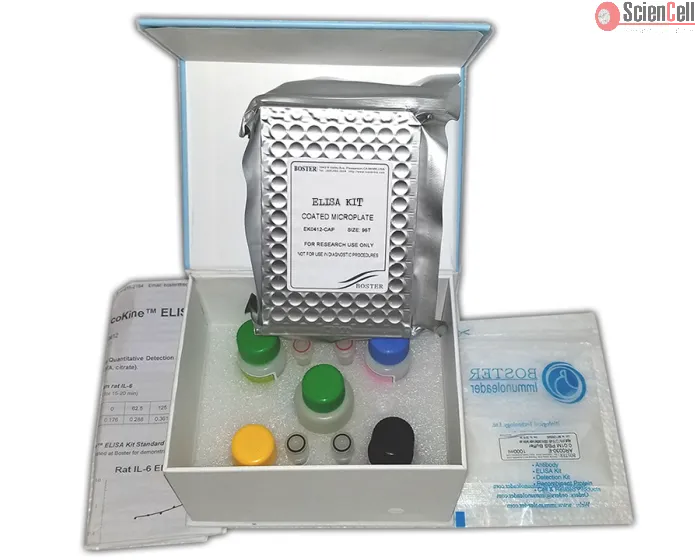 Human E-Selectin ELISA Kit 