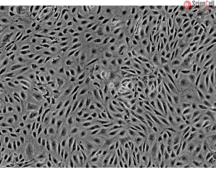 Human Endometrial Microvascular Endothelial Cells (HEMEC)-Phase Contrast