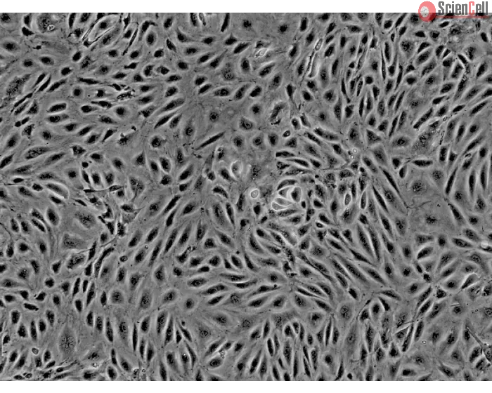 Human Endometrial Microvascular Endothelial Cells (HEMEC)-Phase Contrast, 200x.
