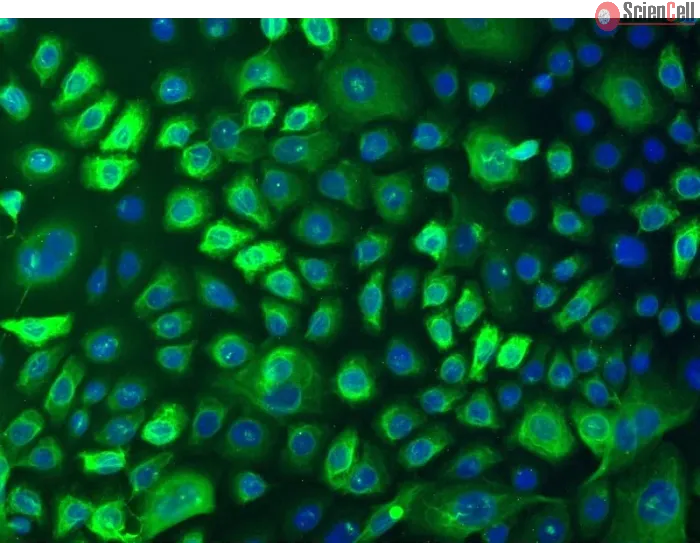 Human Epidermal Keratinocytes-adult (HEK-a) - Immunostaining for CK-18, 100x.
