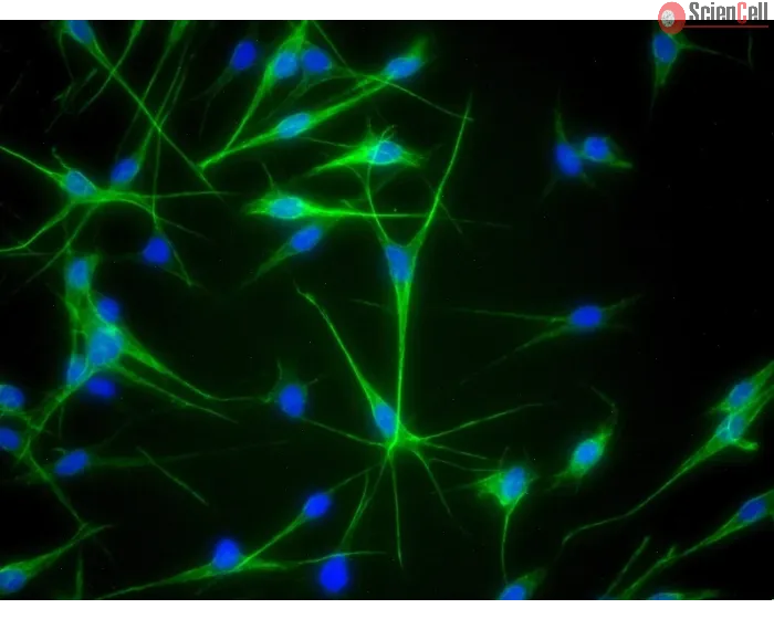 Human Epidermal Melanocytes-medium (HEM-m) - Immunostaining for S100-β, 400x.
