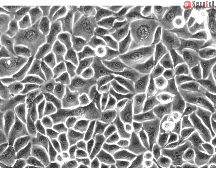 Human Esophageal Epithelial Cells (HEEpiC) - Phase contrast, 200x.
