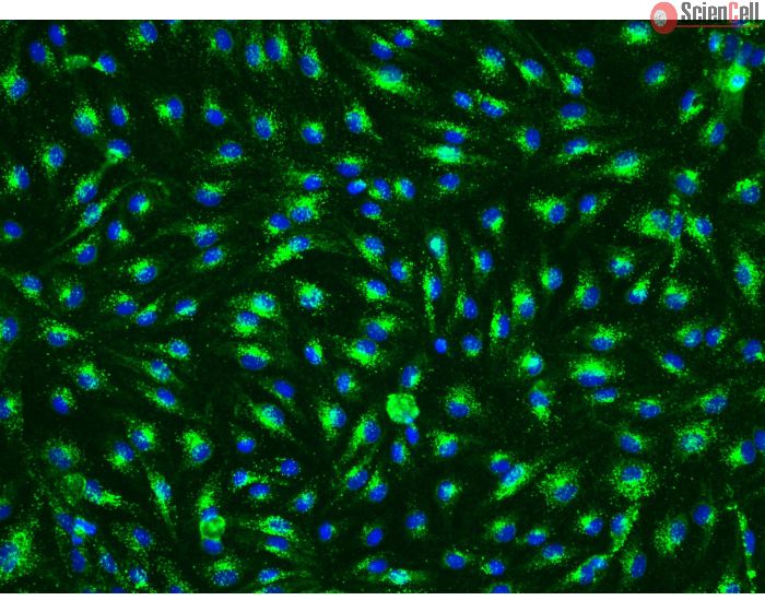 Human Esophageal Endothelial Cells (HEEC) - Immunostaining for Factor VIII