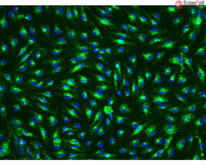 Human Esophageal Endothelial Cells (HEEC) - Immunostaining for vWF, 200x.
