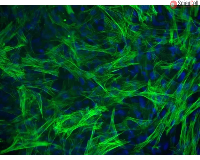 Human Esophageal Smooth Muscle Cells (HESMC) - Immunostaining for α-SMA, 200x.
