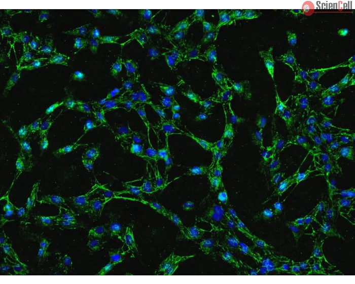 Human Gastric Fibroblasts (HGF)-Immunostaining for FN (Sigma-Aldrich, Cat#3648), 200x.
