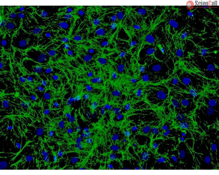 Human Hair Germinal Matrix Cells (HHGMC) - Immunostaining for Fibronectin