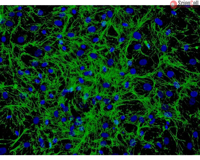 Human Hair Germinal Matrix Cells (HHGMC) - Immunostaining for Fibronectin, 200x.
