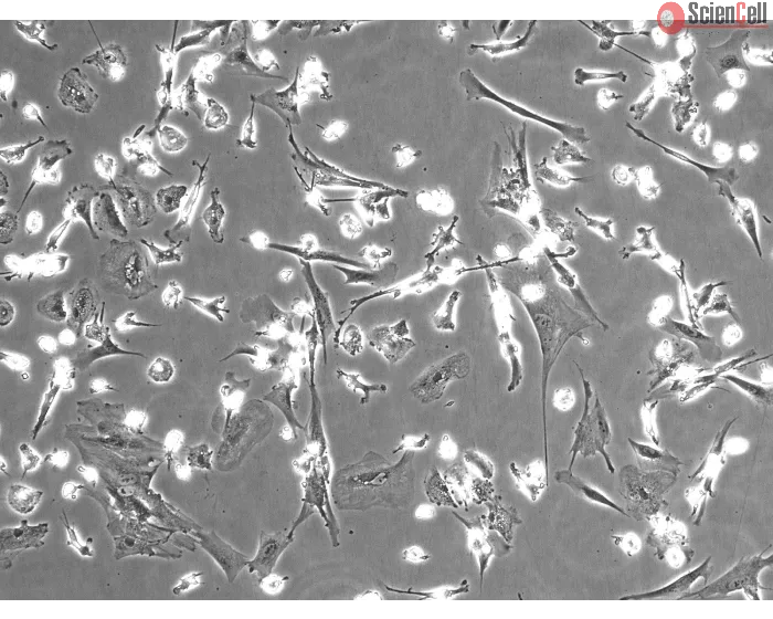 Human Hepatic Macrophages (HHMa) – Phase Contrast, 100x
