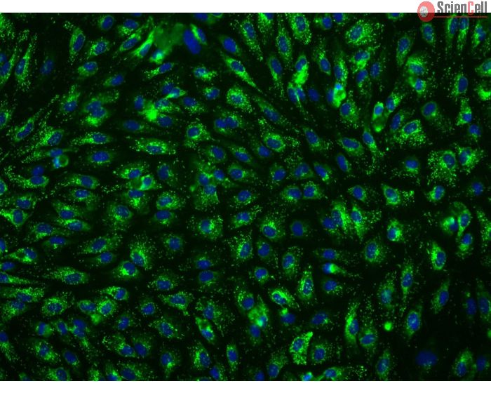 Human Hepatic Sinusoidal Endothelial Cells (HHSEC) - Immunostaining for vWF