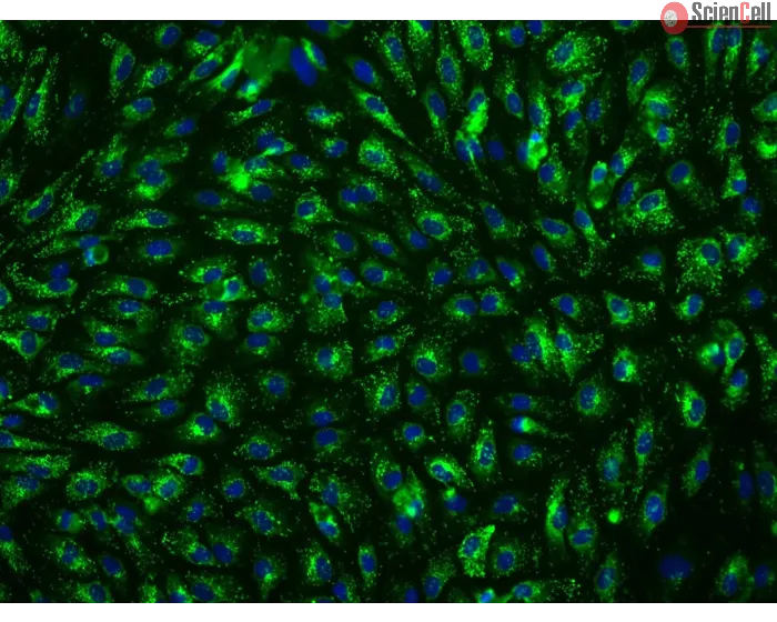 Human Hepatic Sinusoidal Endothelial Cells (HHSEC) - Immunostaining for vWF, 200x
