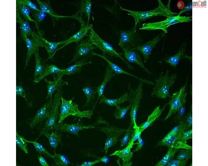 Human Hepatic Stellate Cells (HHSteC) - Immunostaining for α-SMA, 400x.
