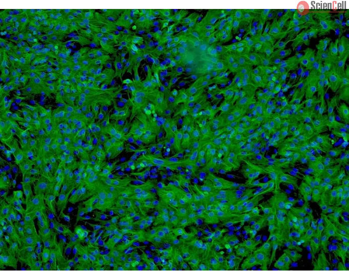 Human Hepatocytes (HH) - Immunostaining for CK-18, 100x.
