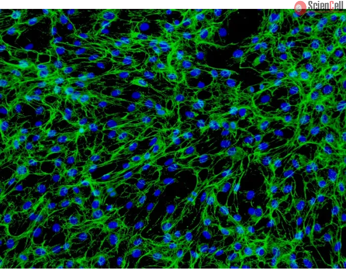 Human Intestinal Fibroblasts (HIF) - Immunostaining for Fibronectin, 200x.
