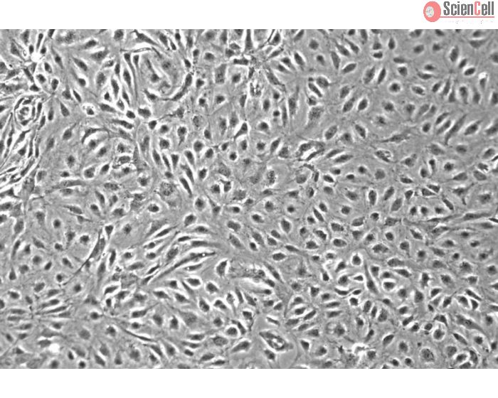 Human Intestinal Microvascular Endothelial Cells (HIMEC) - Phase contrast