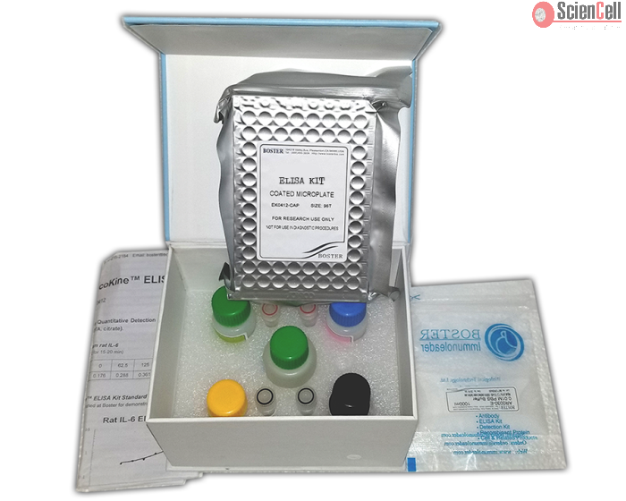 Human Kallikrein 3 ELISA Kit 