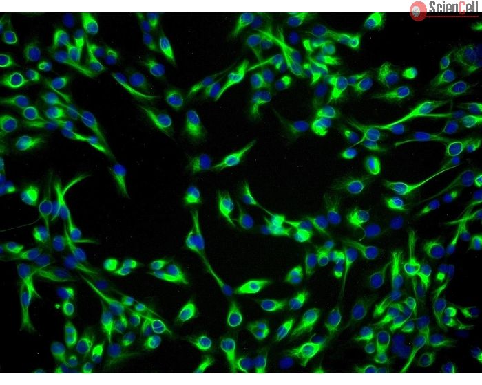 Human Lens Epithelial Cells (HLEpiC) - Immunostaining for CK-19
