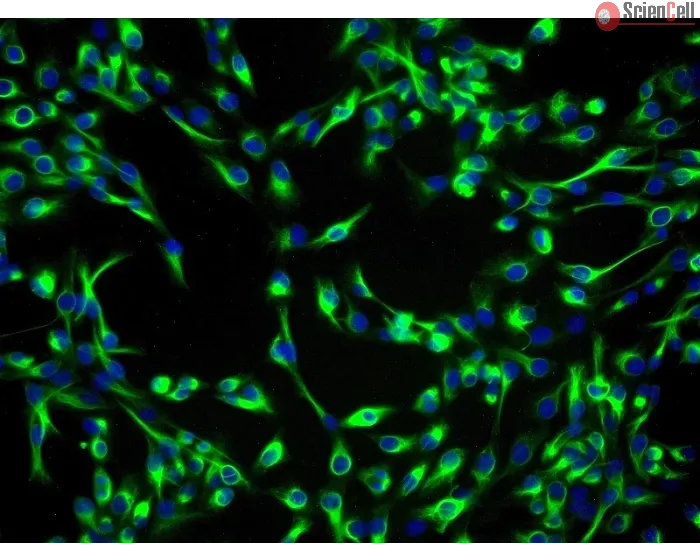 Human Lens Epithelial Cells (HLEpiC) - Immunostaining for CK-19, 200x.
