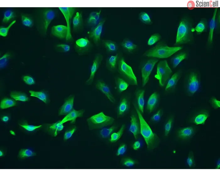Human Leydig Cells (HLC)-Immunostaining for CK-18, 200x..
