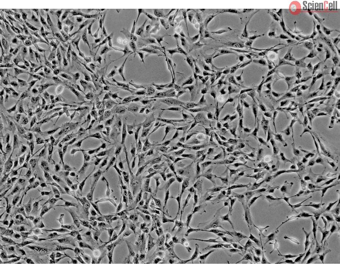 Human Liver-derived Mesenchymal Stem Cells (HMSC-he) - Phase contrast