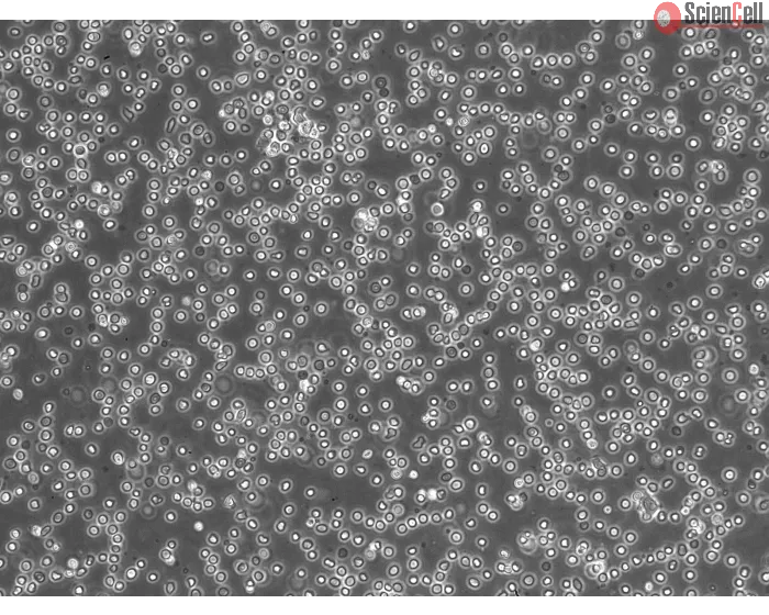 Human Lymphatic Mononuclear Cells (HLyMC) – Phase Contrast, 200x
