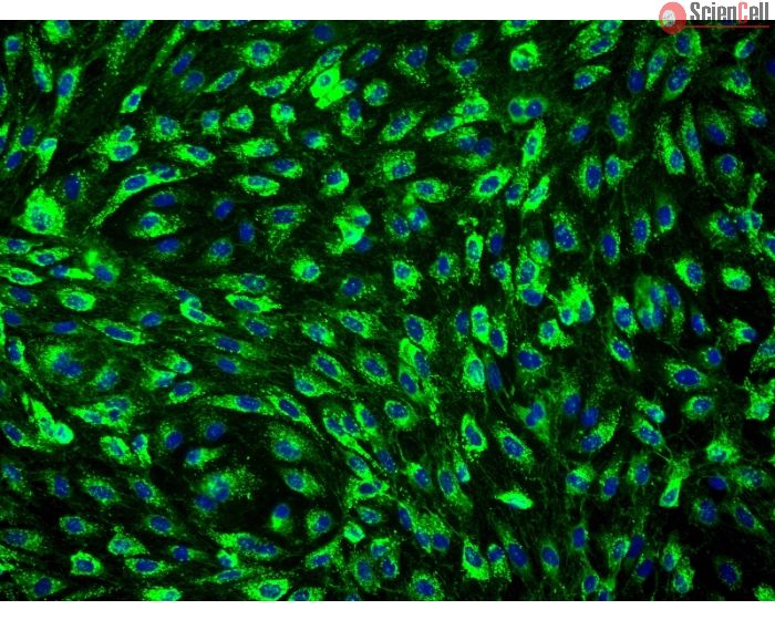 Human Mammary Microvascular Endothelial Cells (HMMEC) - Immunostaining for Factor VIII