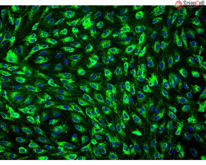 Human Mammary Microvascular Endothelial Cells (HMMEC) - Immunostaining for vWF, 200x.
