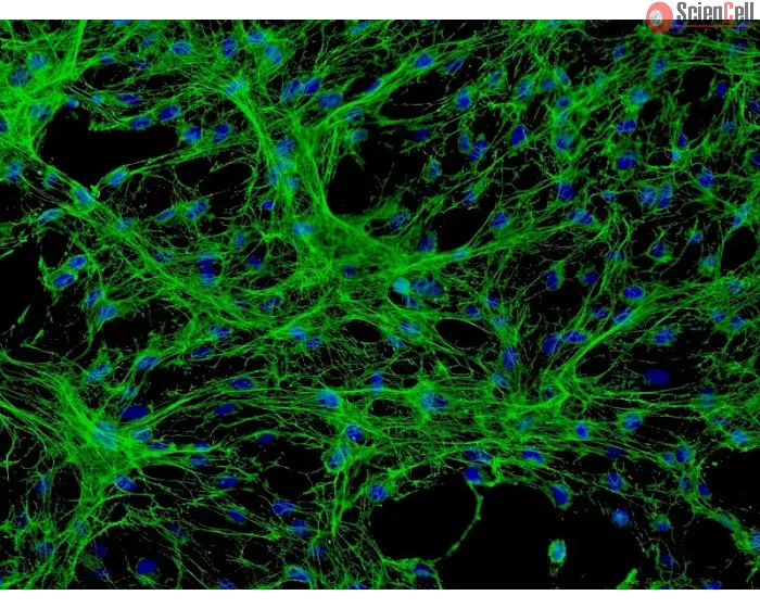 Human Meningeal Cells (HMC) - Immunostaining for Fibronectin, 200x.
