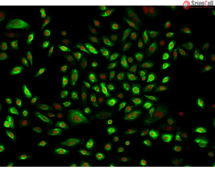 Human Middle Ear Epithelial Cells (HMEEpiC)-Immunostaining for CK-18, 200x