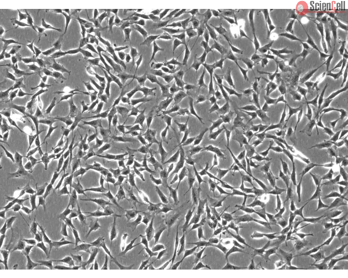 Human Middle Ear Fibroblasts (HMEF)-Phase Contrast, 100x