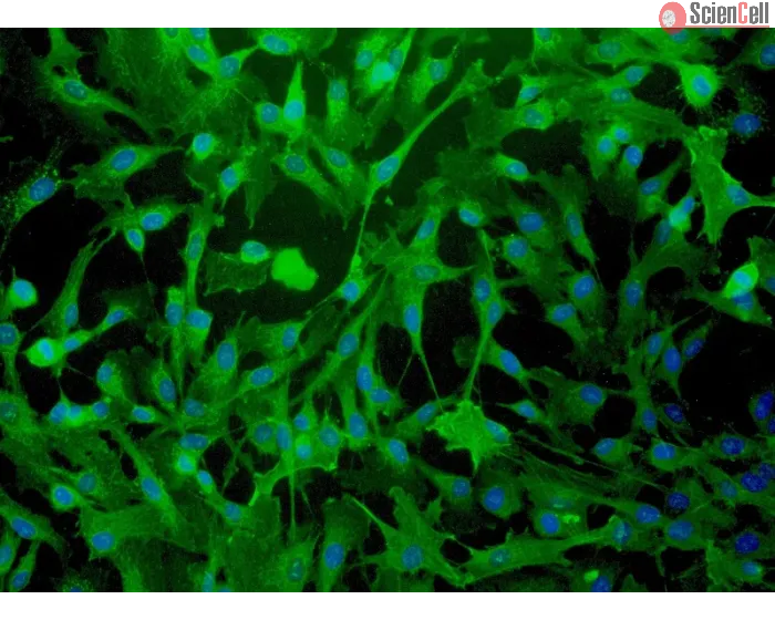 Human Myometrial Smooth Muscle Cells (HMSMC)-Immunostaining for α-sma, 200x.
