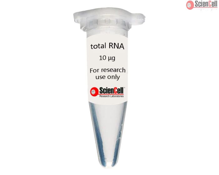 Human Neuron Total RNA