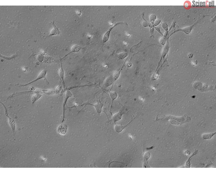 Human Neurons-brain stem (HN-bs) - Relief contrast