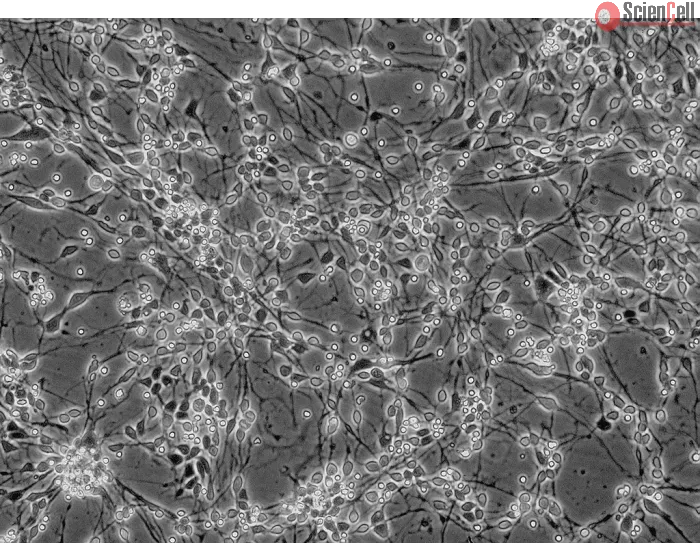 Human Neurons-midbrain (HN-mb) - Phase contrast, 200x.

