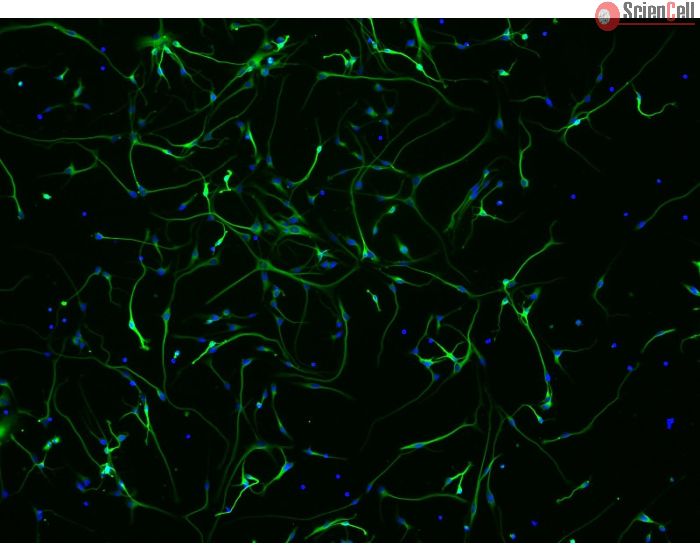 Human Neurons (HN) - immunostained for beta tubulin III (green), 200x
