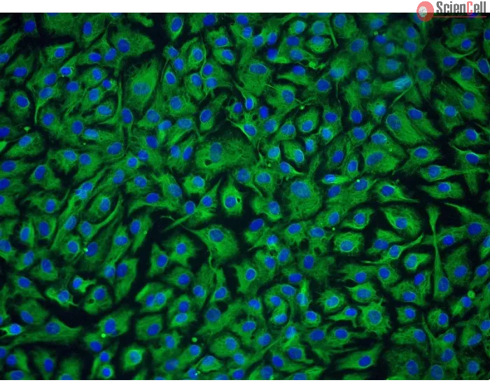 Human Nucleus Pulposus Cells (HNPC) - Immunostaining for Vimentin, 200x.
