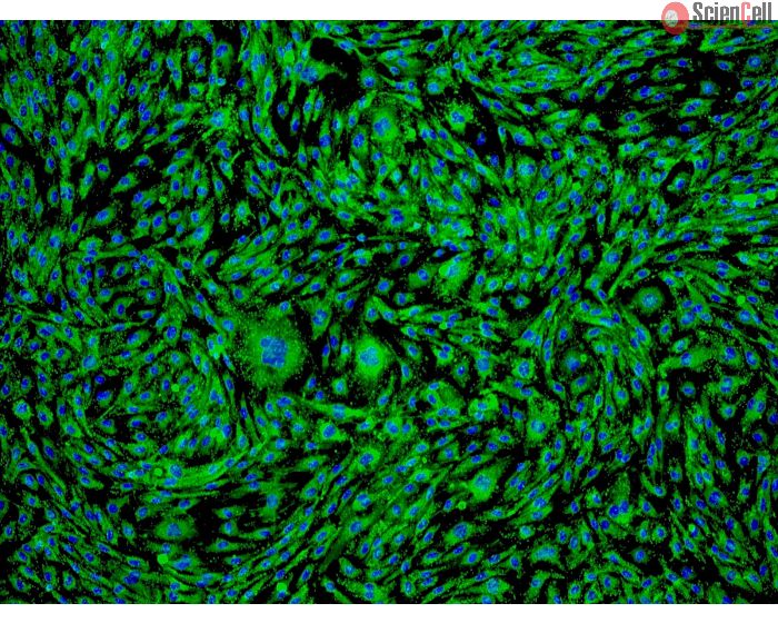 Human Ovarian Microvascular Endothelial Cells (HOMEC) - Immunostaining for Factor VIII