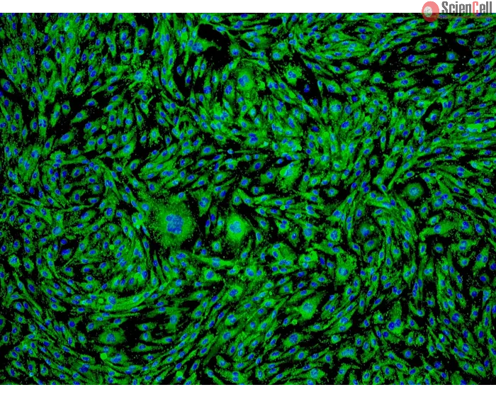 Human Ovarian Microvascular Endothelial Cells (HOMEC) - Immunostaining for vWF, 100x.

