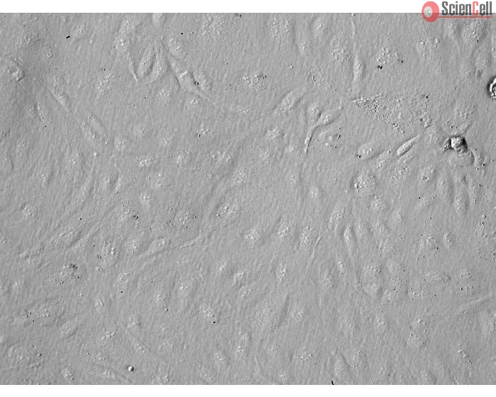 Human Pancreatic Microvascular Endothelial Cells (HPaMEC)-Relief Contrast, 200x.

