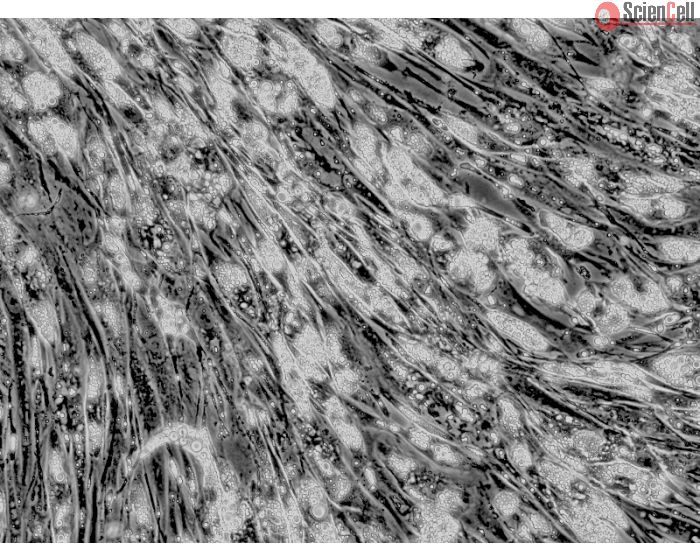 Intracellular lipid droplets are visible after differentiation