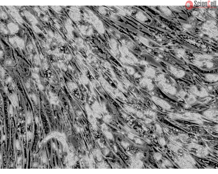 Intracellular lipid droplets are visible after differentiation, 400x.