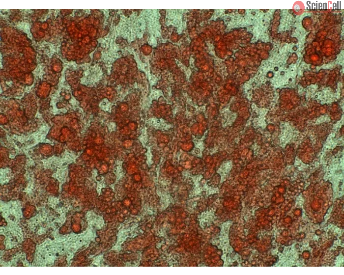 Human Preadipocytes-visceral (HPA-v) - Intracellular lipid droplets are visible after differentiation by Oil Red O staining, 400x.