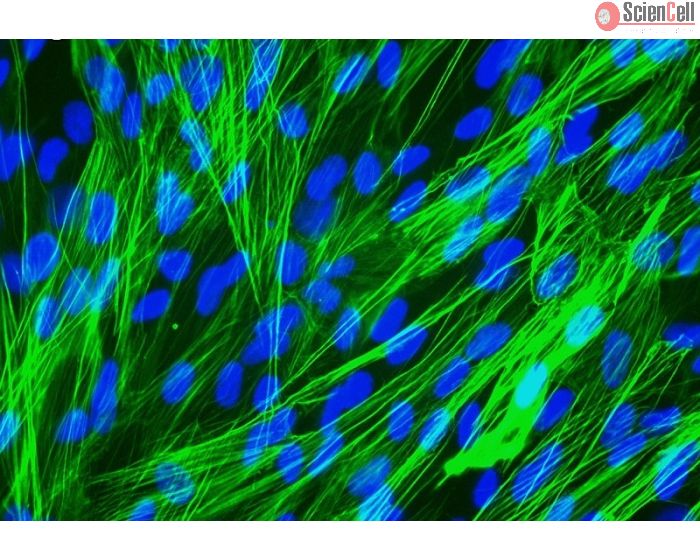 Human Pulmonary Artery Smooth Muscle Cells [HPASMC] - Immunostaining for &alpha;-SMA