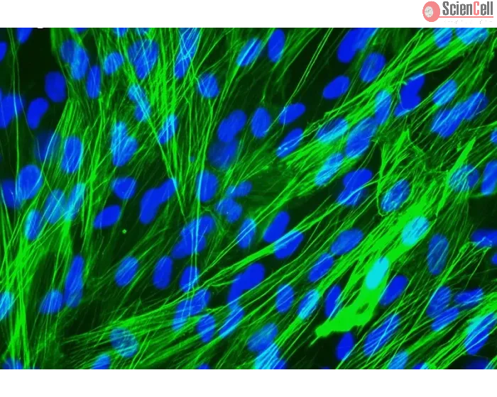 Human Pulmonary Artery Smooth Muscle Cells [HPASMC] - Immunostaining for α-SMA, 400x.
