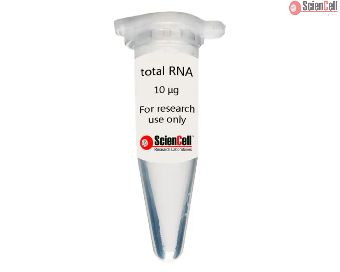 Human Pulmonary Mesenchymal Stem Cell total RNA