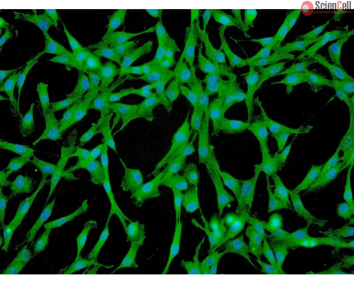 Human Pulmonary Mesenchymal Stem Cells (HPMSC) - Immunostaining for CD73, 200x.
