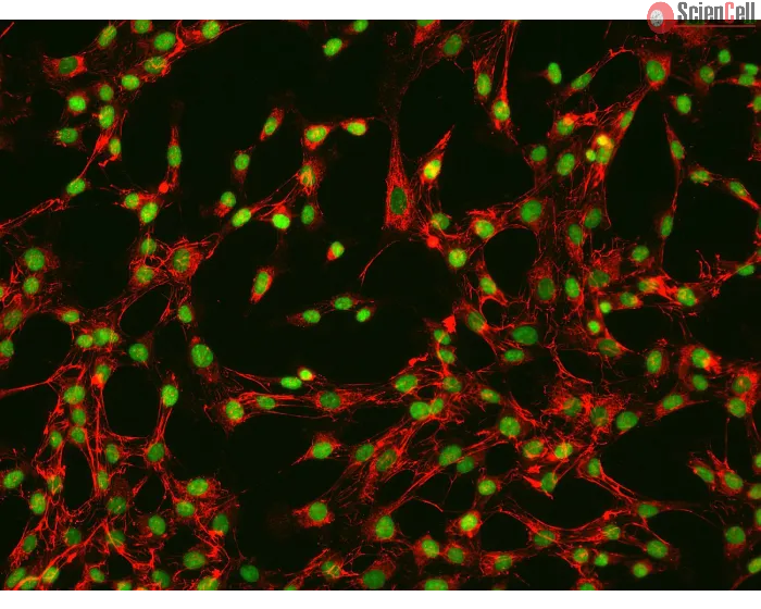 Human Rectal Fibroblasts (HRecF)-Immunostaining for Fibronectin, 200x.
