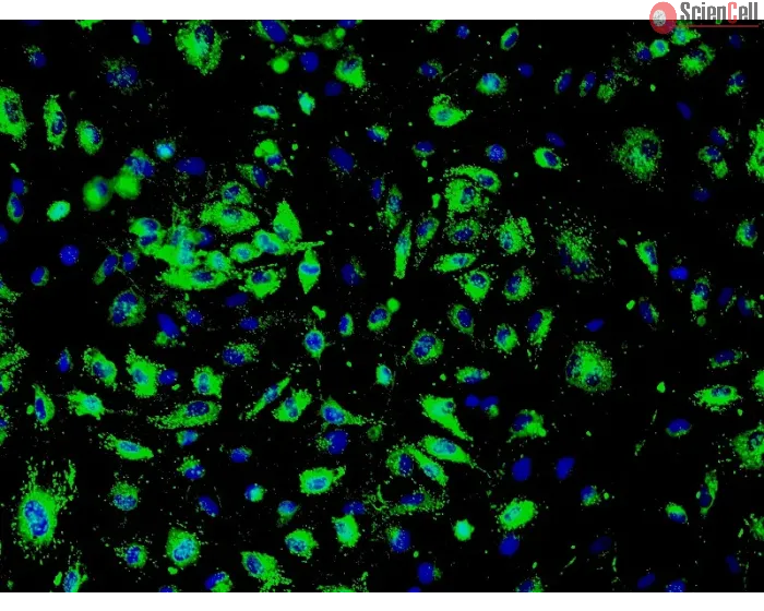 Human Renal Glomerular Endothelial Cells (HRGEC) - Immunostaining for vWF, 200x.

