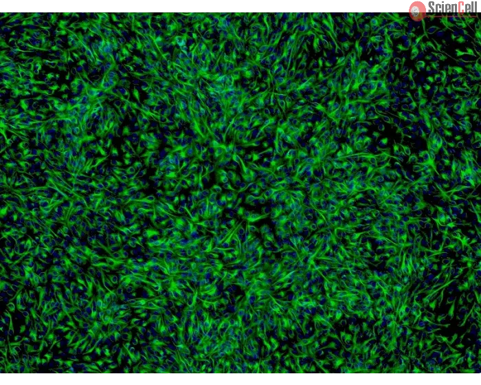 Human Retinal Pigment Epithelial Cells (HRPEpiC) - Immunostaining for CK-18, 200x.
