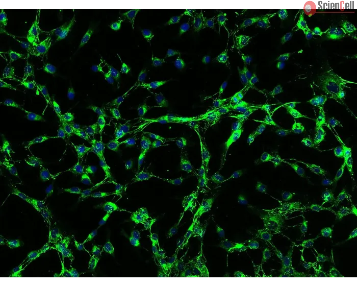 Human Scalp Fibroblasts-fetal (HScF-f) - Immunostaining for Fibronectin, 200x.
